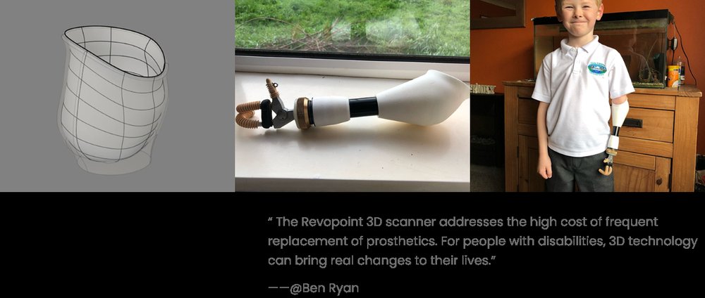 Digitalização 3D para próteses e órteses personalizadas